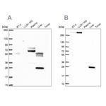 QDPR Antibody in Western Blot (WB)