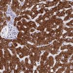 CYP4F2 Antibody in Immunohistochemistry (IHC)