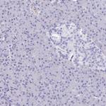 PITPNM3 Antibody in Immunohistochemistry (IHC)