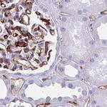 PITPNM3 Antibody in Immunohistochemistry (IHC)