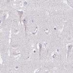 PITPNM3 Antibody in Immunohistochemistry (IHC)