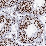 NOLA1 Antibody in Immunohistochemistry (IHC)