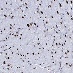 NOLA1 Antibody in Immunohistochemistry (IHC)