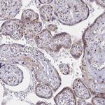 RAB6A Antibody in Immunohistochemistry (Paraffin) (IHC (P))