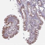 RAB6A Antibody in Immunohistochemistry (Paraffin) (IHC (P))