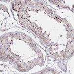 RAB6A Antibody in Immunohistochemistry (Paraffin) (IHC (P))