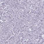 HSD17B6 Antibody in Immunohistochemistry (IHC)