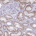 NNMT Antibody in Immunohistochemistry (Paraffin) (IHC (P))