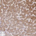 NNMT Antibody in Immunohistochemistry (Paraffin) (IHC (P))