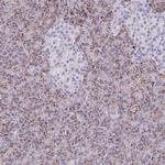 NNMT Antibody in Immunohistochemistry (Paraffin) (IHC (P))