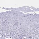 NNMT Antibody in Immunohistochemistry (Paraffin) (IHC (P))