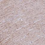 MYL12A Antibody in Immunohistochemistry (Paraffin) (IHC (P))