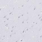 NOLA3 Antibody in Immunohistochemistry (Paraffin) (IHC (P))