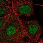 PSD Antibody in Immunocytochemistry (ICC/IF)