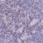 PSD Antibody in Immunohistochemistry (IHC)