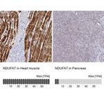 NDUFA7 Antibody in Immunohistochemistry (IHC)