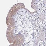 NDUFA7 Antibody in Immunohistochemistry (IHC)