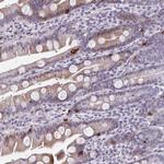 ABHD16B Antibody in Immunohistochemistry (Paraffin) (IHC (P))