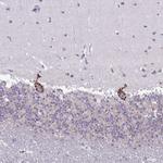 DTX4 Antibody in Immunohistochemistry (Paraffin) (IHC (P))