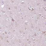 DTX4 Antibody in Immunohistochemistry (Paraffin) (IHC (P))