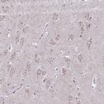 DTX4 Antibody in Immunohistochemistry (Paraffin) (IHC (P))