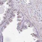 DTX4 Antibody in Immunohistochemistry (Paraffin) (IHC (P))