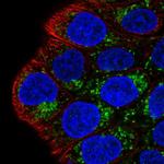 MAOA Antibody in Immunocytochemistry (ICC/IF)