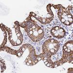 MAOA Antibody in Immunohistochemistry (IHC)