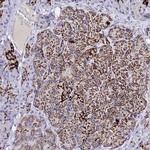 MAOA Antibody in Immunohistochemistry (IHC)