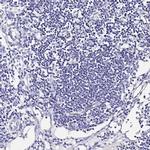 MAOA Antibody in Immunohistochemistry (IHC)