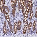 MAOA Antibody in Immunohistochemistry (IHC)