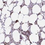 ZNF221 Antibody in Immunohistochemistry (Paraffin) (IHC (P))