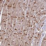 SLC9A6 Antibody in Immunohistochemistry (Paraffin) (IHC (P))