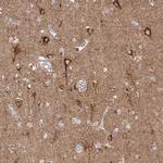 SLC9A6 Antibody in Immunohistochemistry (IHC)