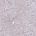 SLC9A6 Antibody in Immunohistochemistry (IHC)