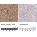 SLC9A6 Antibody