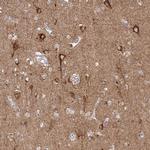 SLC9A6 Antibody in Immunohistochemistry (IHC)