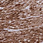 DOK7 Antibody in Immunohistochemistry (Paraffin) (IHC (P))