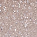 MUS81 Antibody in Immunohistochemistry (Paraffin) (IHC (P))