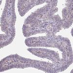 MUS81 Antibody in Immunohistochemistry (Paraffin) (IHC (P))