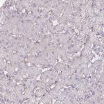 MUS81 Antibody in Immunohistochemistry (Paraffin) (IHC (P))