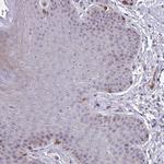 MUS81 Antibody in Immunohistochemistry (Paraffin) (IHC (P))