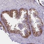 SLC14A1 Antibody in Immunohistochemistry (Paraffin) (IHC (P))