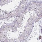 SLC14A1 Antibody in Immunohistochemistry (Paraffin) (IHC (P))