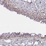 SLC14A1 Antibody in Immunohistochemistry (Paraffin) (IHC (P))