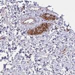 SLC14A1 Antibody in Immunohistochemistry (Paraffin) (IHC (P))