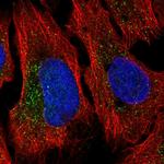 SLC9A6 Antibody in Immunocytochemistry (ICC/IF)