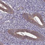 SLC9A6 Antibody in Immunohistochemistry (Paraffin) (IHC (P))