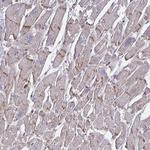 SLC9A6 Antibody in Immunohistochemistry (Paraffin) (IHC (P))