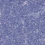 IYD Antibody in Immunohistochemistry (Paraffin) (IHC (P))